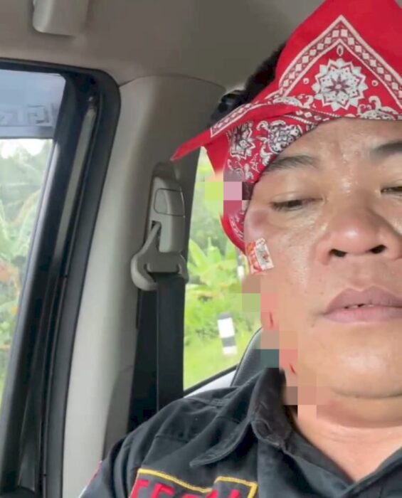 Demo Di Depan Kantor KPU Pesawaran Sempat Ricuh, Masa Aksi Alami Luka Jahitan